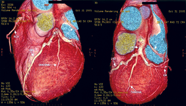 Dec_2006_Update_Article-_Figure_2